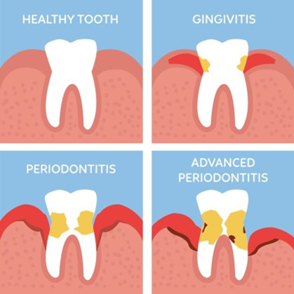 Aura Dental