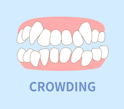 Crowding